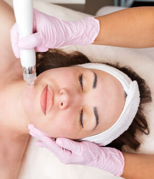 Micro Needling